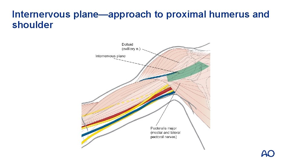 Internervous plane—approach to proximal humerus and shoulder 