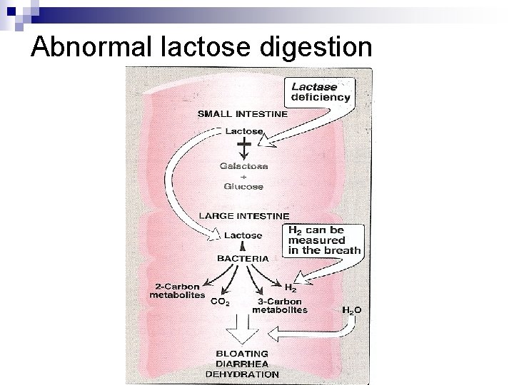 Abnormal lactose digestion Hanadi Baeissa Abnormal lactose digestion Hanadi Baeissa