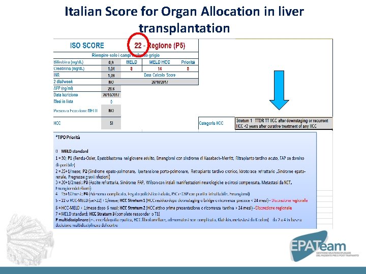 Italian Score for Organ Allocation in liver transplantation 