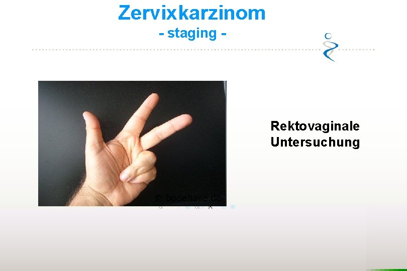 Zervixkarzinom - staging - Rektovaginale Untersuchung 