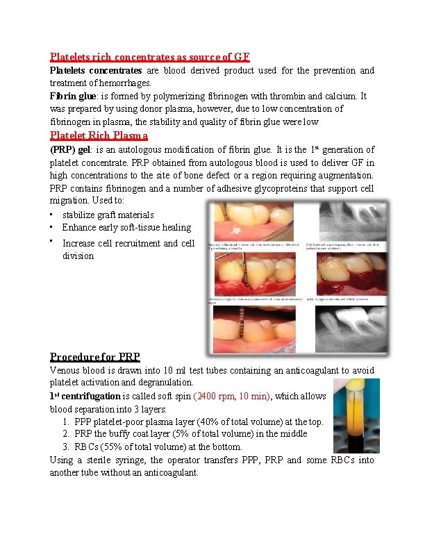 Platelets rich concentrates as source of GF Platelets concentrates are blood derived product used