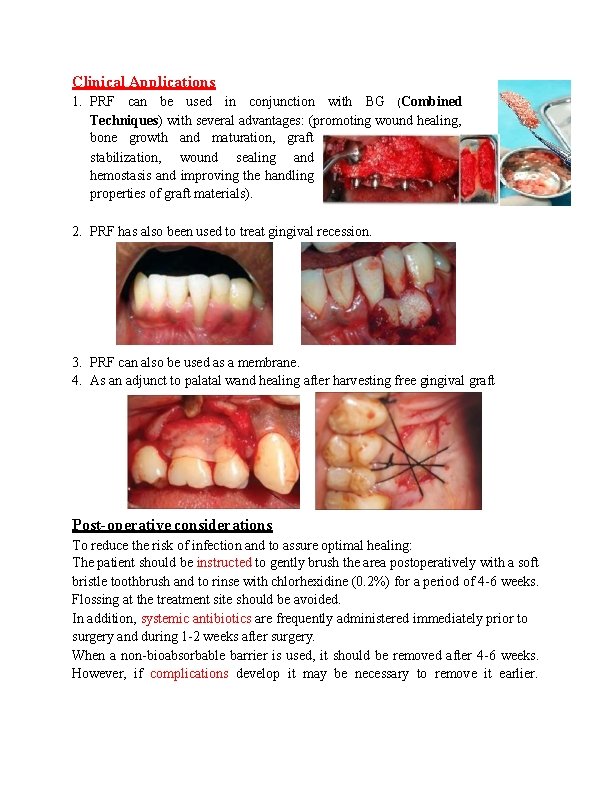 Clinical Applications 1. PRF can be used in conjunction with BG (Combined Techniques) with