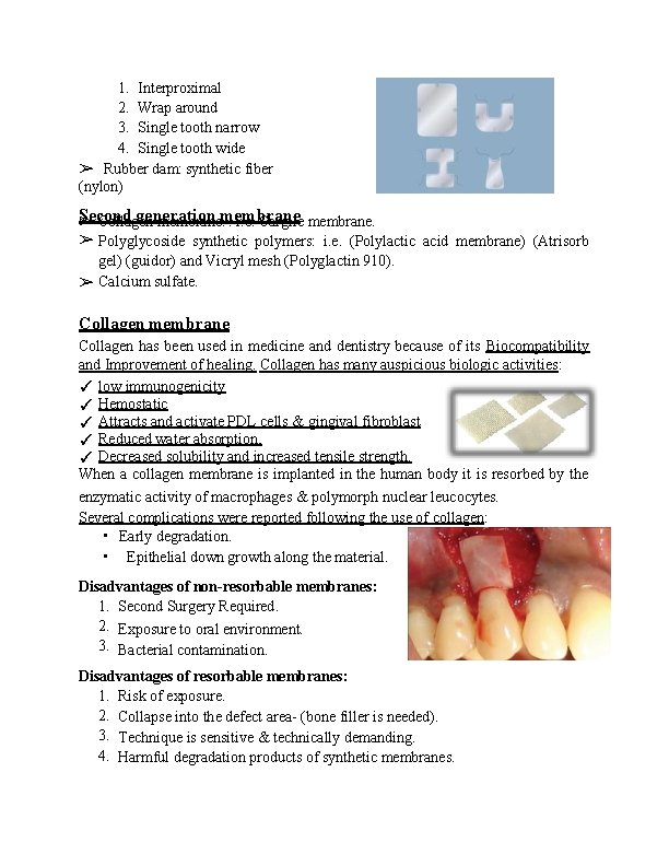 1. Interproximal 2. Wrap around 3. Single tooth narrow 4. Single tooth wide ➢