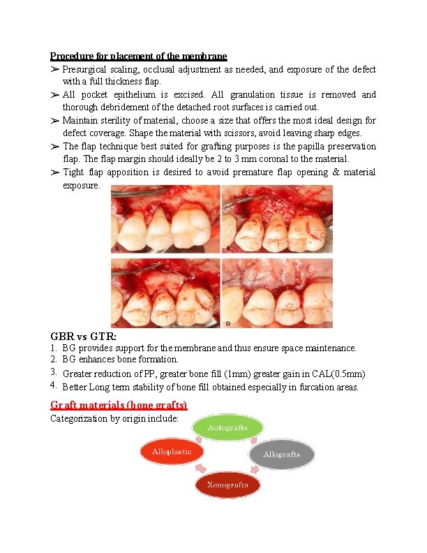 Procedure for placement of the membrane ➢ Presurgical scaling, occlusal adjustment as needed, and