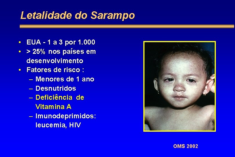 Letalidade do Sarampo • EUA - 1 a 3 por 1. 000 • >