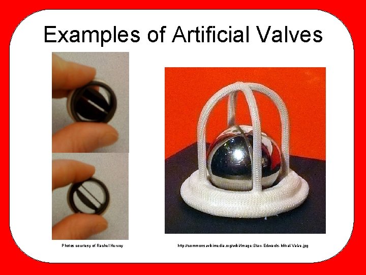 Examples of Artificial Valves Photos courtesy of Rachel Hervey http: //commons. wikimedia. org/wiki/Image: Starr-Edwards-Mitral-Valve.