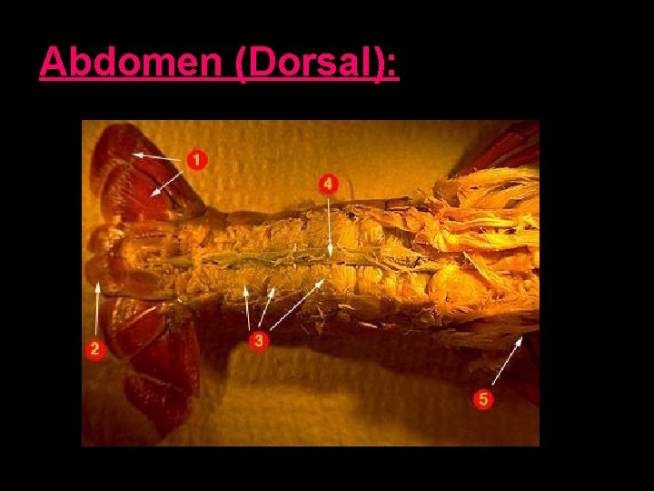 Abdomen (Dorsal): 