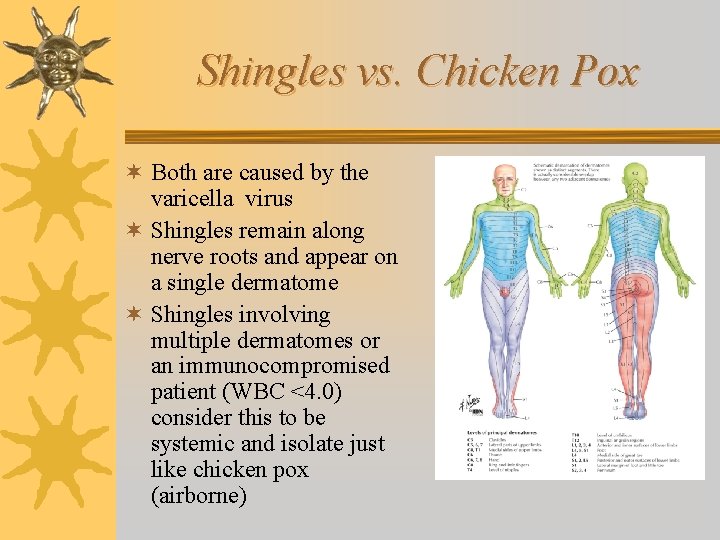 Shingles vs. Chicken Pox ¬ Both are caused by the varicella virus ¬ Shingles