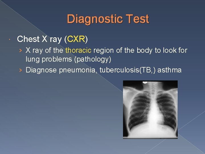 Diagnostic Test Chest X ray (CXR) › X ray of the thoracic region of