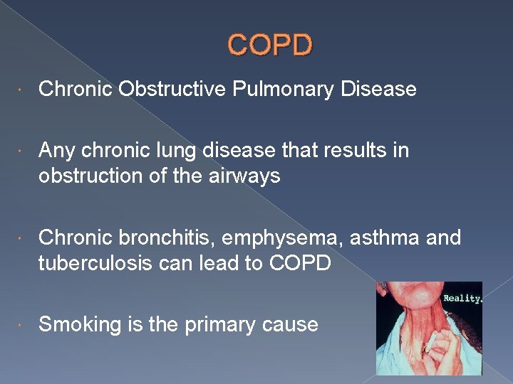 COPD Chronic Obstructive Pulmonary Disease Any chronic lung disease that results in obstruction of