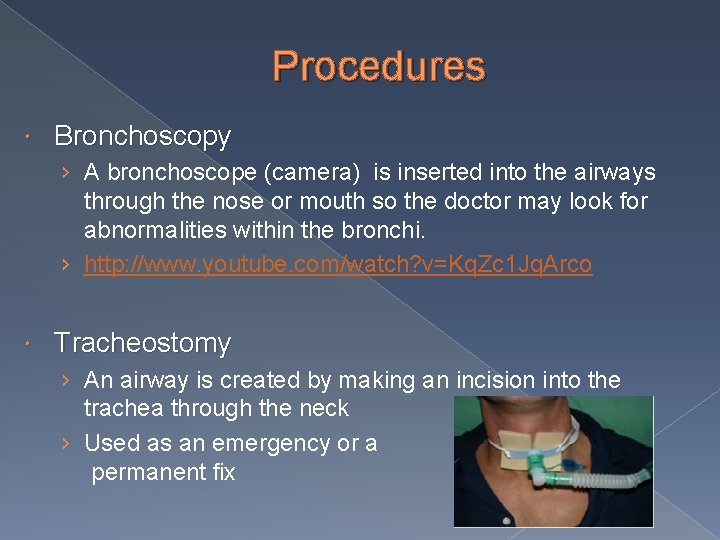Procedures Bronchoscopy › A bronchoscope (camera) is inserted into the airways through the nose