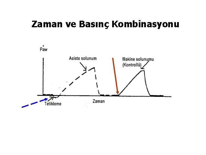 Zaman ve Basınç Kombinasyonu 