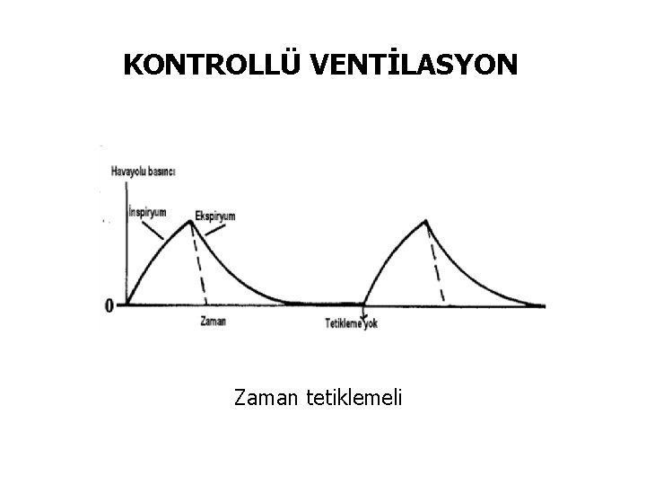 KONTROLLÜ VENTİLASYON Zaman tetiklemeli 