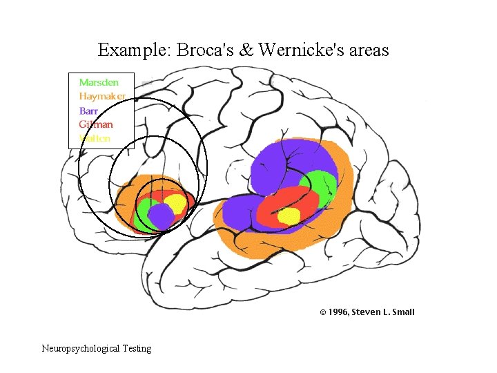 Example: Broca's & Wernicke's areas Neuropsychological Testing 