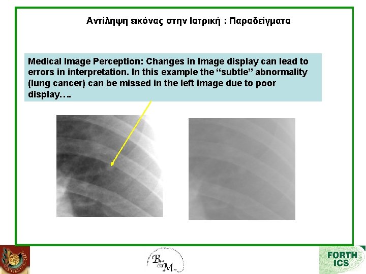 Αντίληψη εικόνας στην Ιατρική : Παραδείγματα Medical Image Perception: Changes in Image display can
