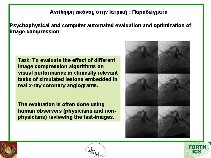 Αντίληψη εικόνας στην Ιατρική : Παραδείγματα Psychophysical and computer automated evaluation and optimization of