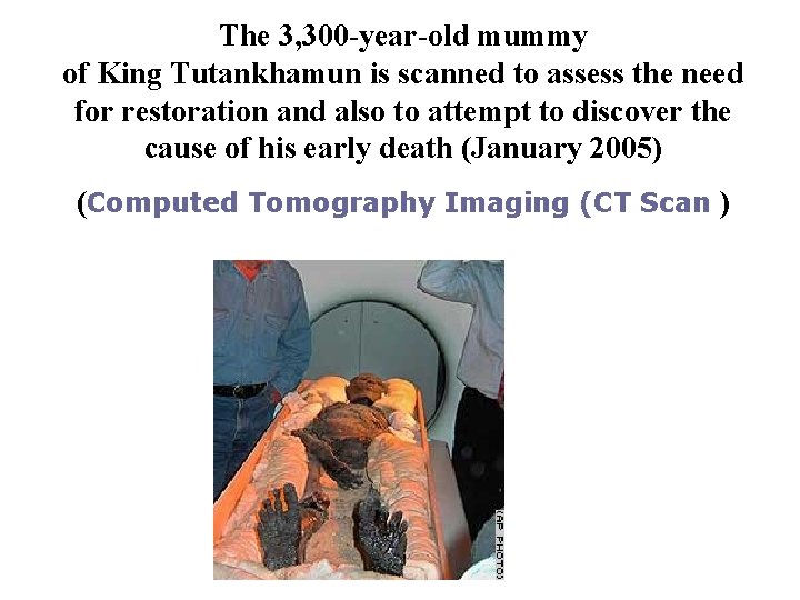 The 3, 300 -year-old mummy of King Tutankhamun is scanned to assess the need