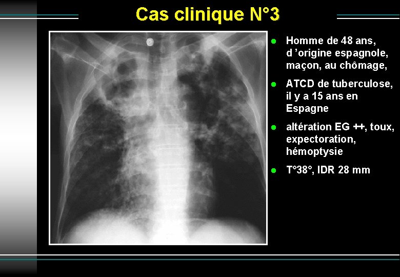 Cas clinique N° 3 Homme de 48 ans, d ’origine espagnole, maçon, au chômage,