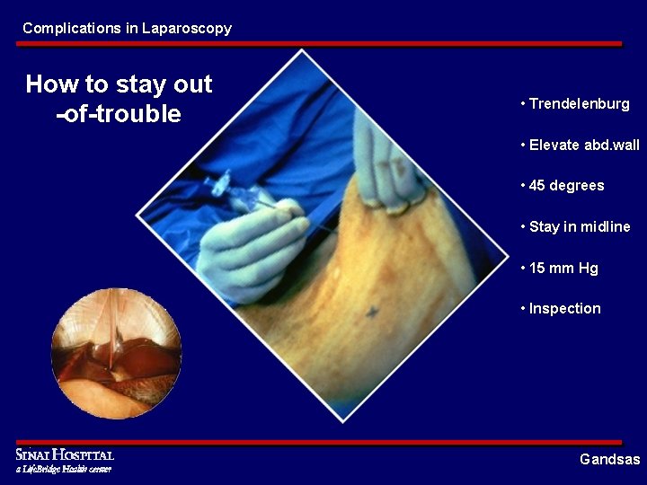 Complications in Laparoscopy How to stay out -of-trouble • Trendelenburg • Elevate abd. wall