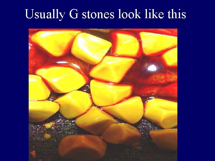 Usually G stones look like this 