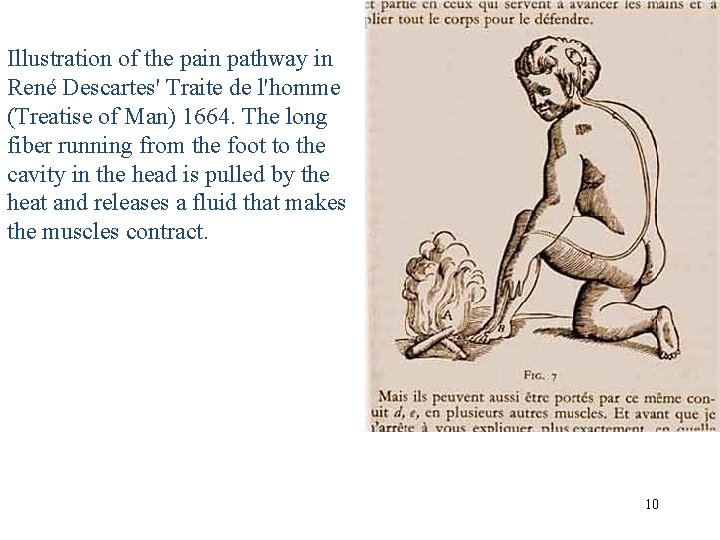 Illustration of the pain pathway in René Descartes' Traite de l'homme (Treatise of Man)