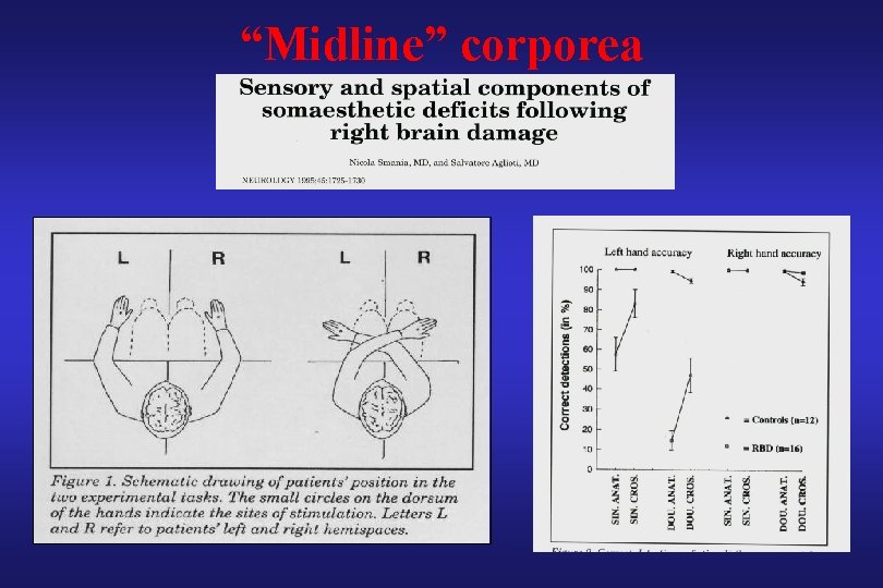 “Midline” corporea 