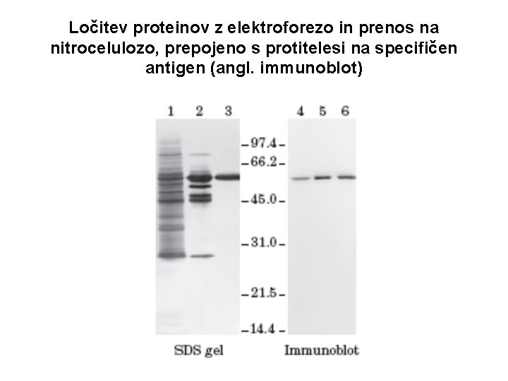 Ločitev proteinov z elektroforezo in prenos na nitrocelulozo, prepojeno s protitelesi na specifičen antigen