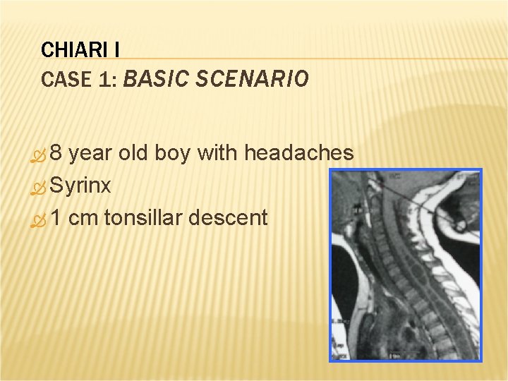 CHIARI I CASE 1: BASIC SCENARIO 8 year old boy with headaches Syrinx 1