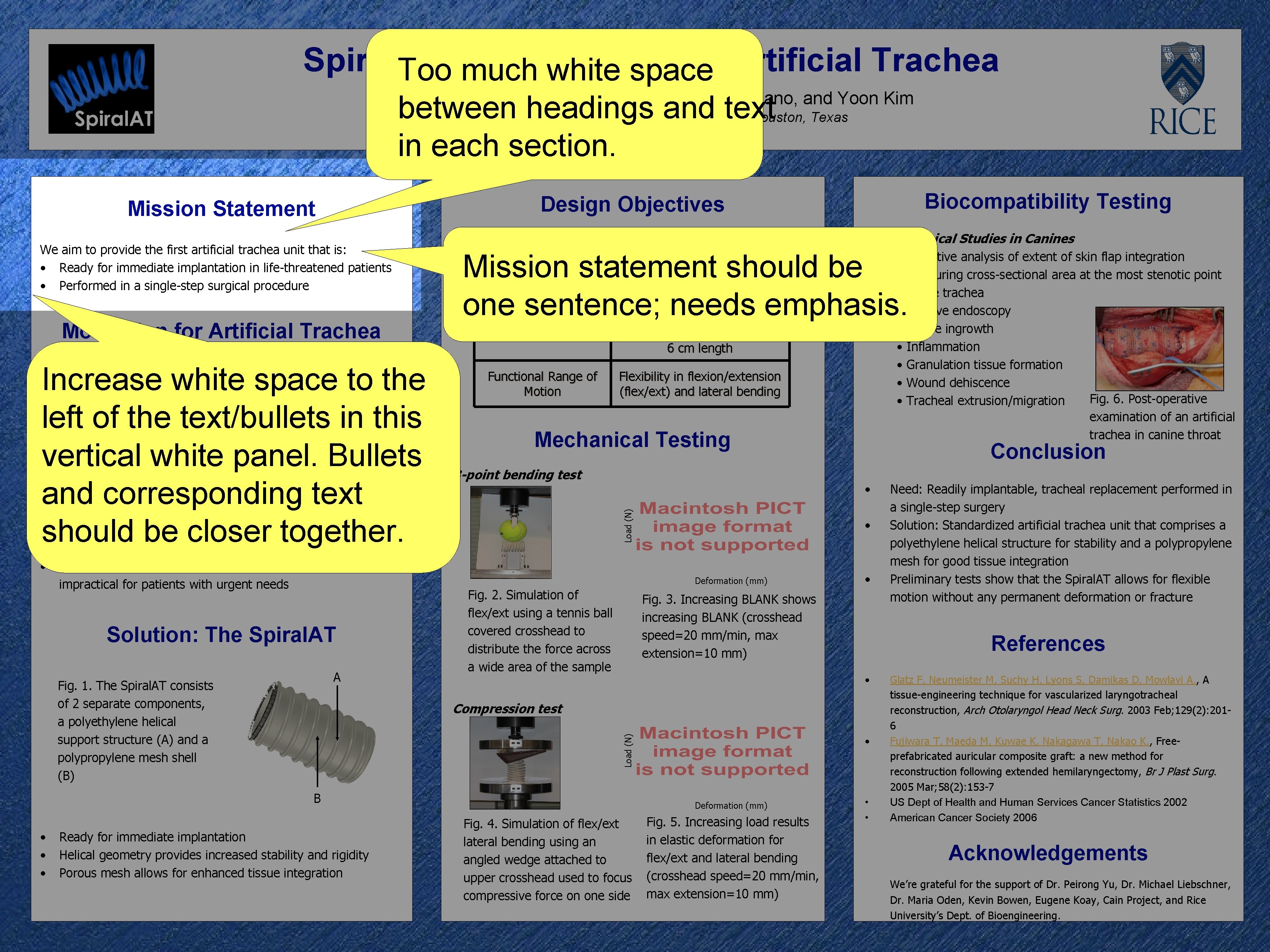 Spiral. AT: First Generation Artificial Trachea Too much white space Theodore John, Insiya Hussain,