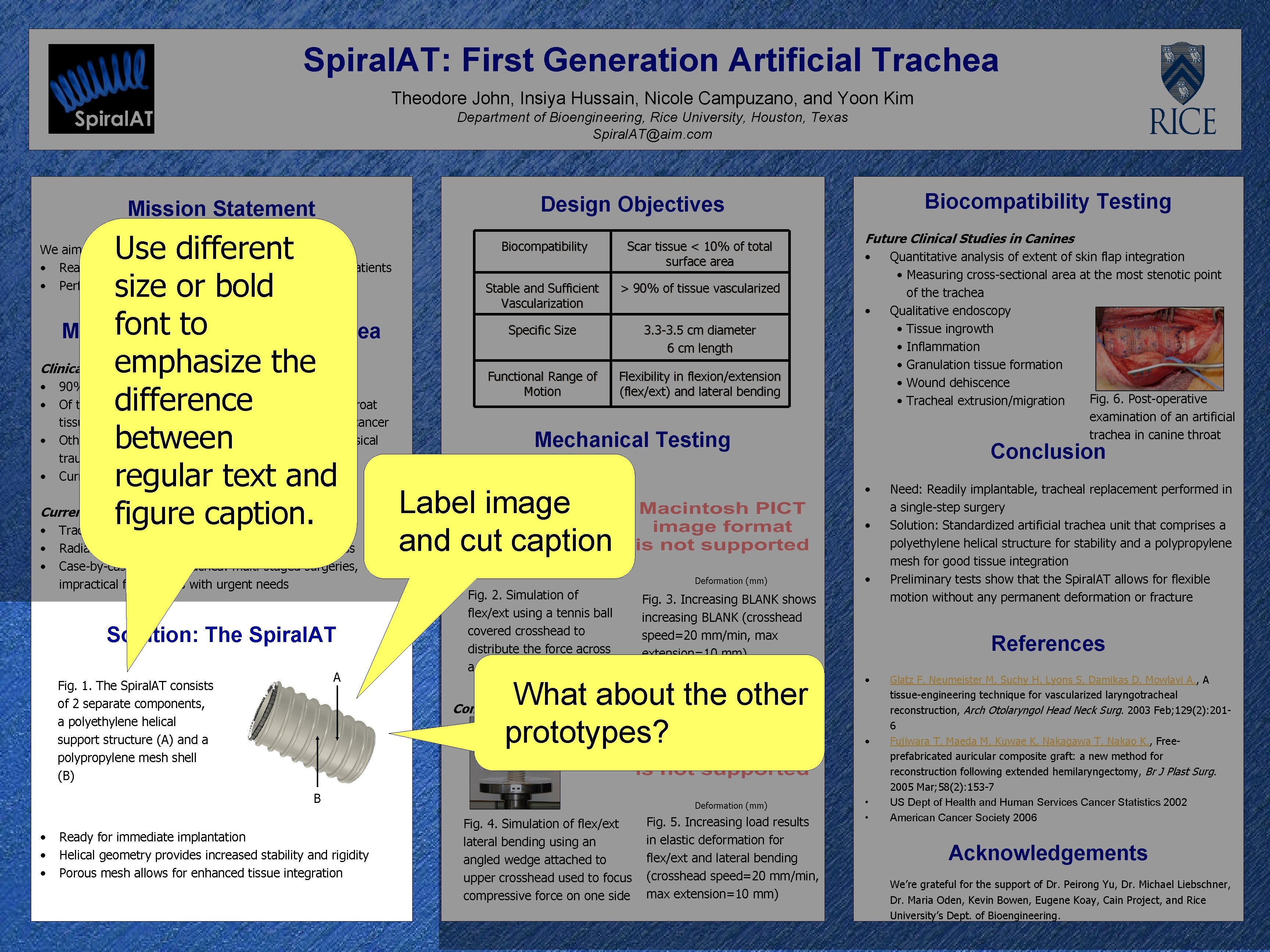 Spiral. AT: First Generation Artificial Trachea Theodore John, Insiya Hussain, Nicole Campuzano, and Yoon