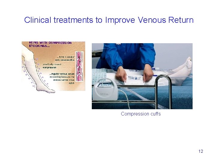 Clinical treatments to Improve Venous Return Compression cuffs 12 