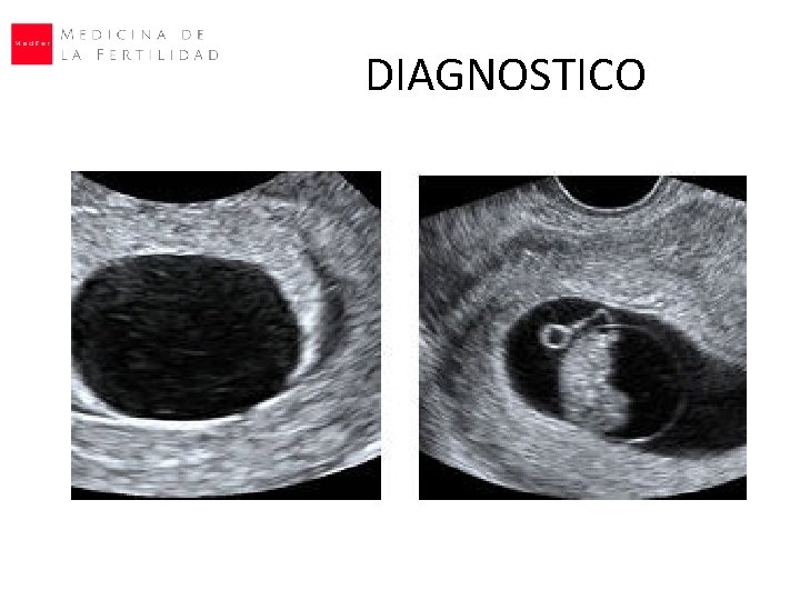 DIAGNOSTICO 