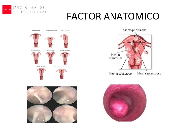 FACTOR ANATOMICO 