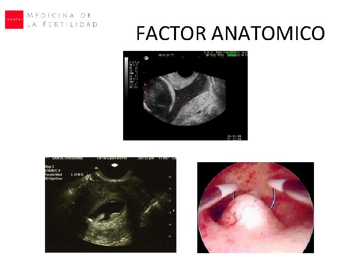 FACTOR ANATOMICO 