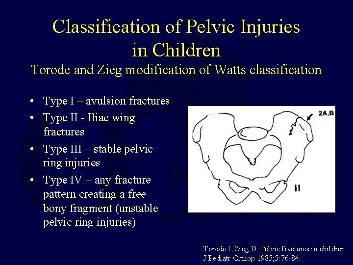 Classification of Pelvic Injuries in Children Torode and Zieg modification of Watts classification •