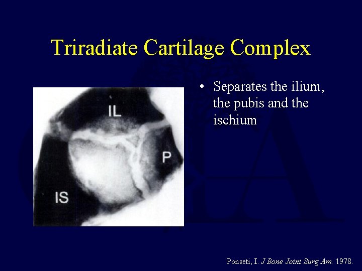 Triradiate Cartilage Complex • Separates the ilium, the pubis and the ischium Ponseti, I.