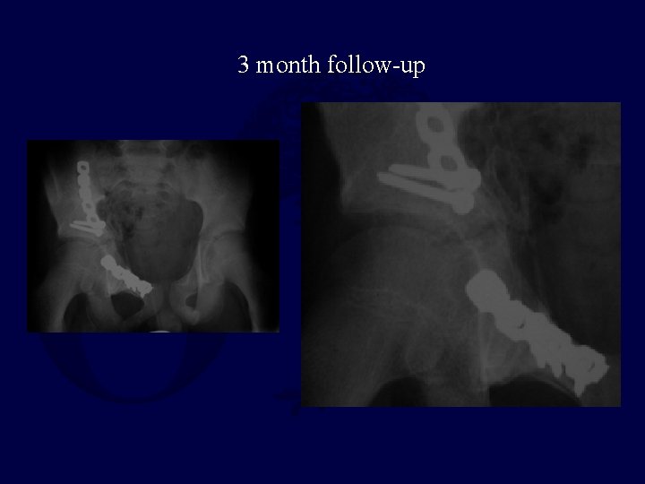 3 month follow-up 