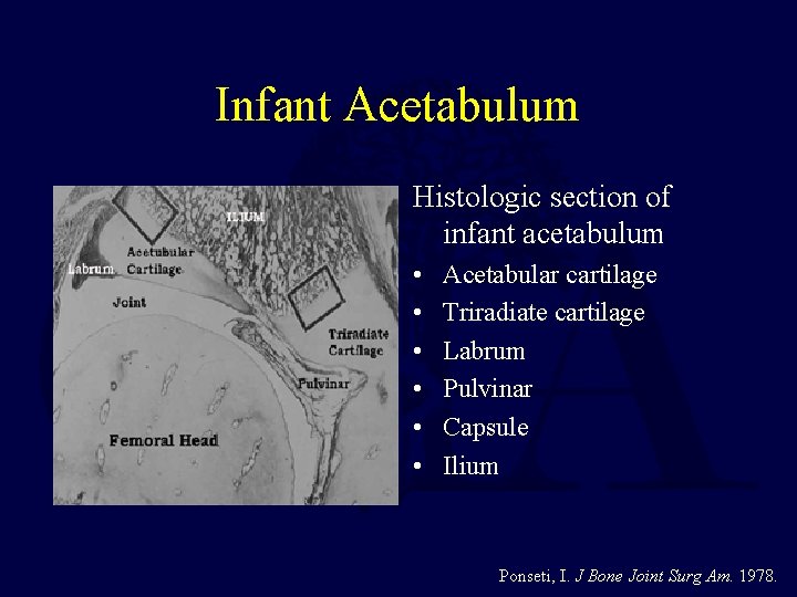 Infant Acetabulum Histologic section of infant acetabulum • • • Acetabular cartilage Triradiate cartilage
