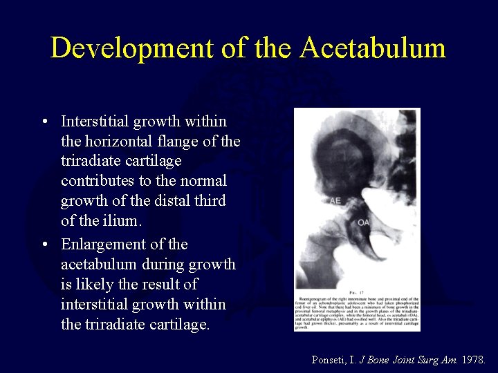 Development of the Acetabulum • Interstitial growth within the horizontal flange of the triradiate