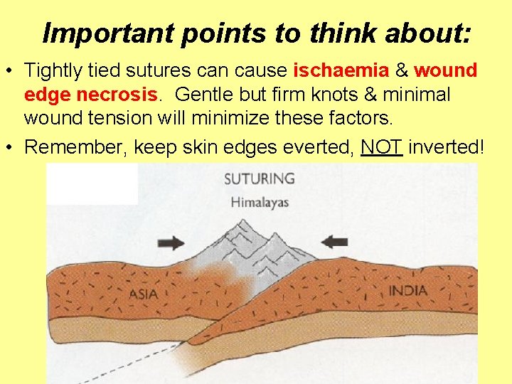 Important points to think about: • Tightly tied sutures can cause ischaemia & wound