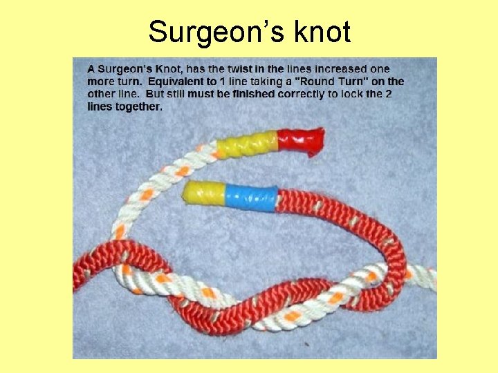 Surgeon’s knot 