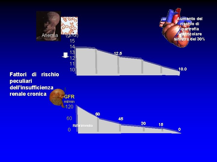 Aumento del rischio di ipertrofia ventricolare sinistra del 30% Hb Anemia (gr/dl) 15 14