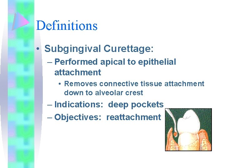 Gingival Curettage Wilkins chapter Learning Objectives Distinguish between