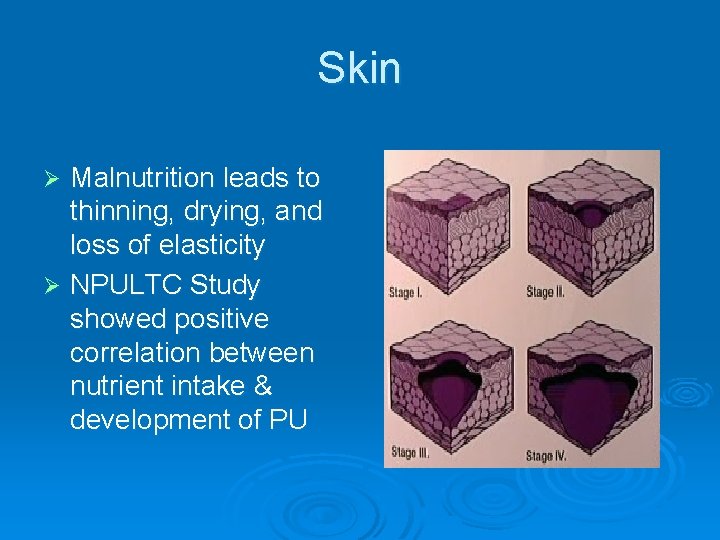 Skin Malnutrition leads to thinning, drying, and loss of elasticity Ø NPULTC Study showed