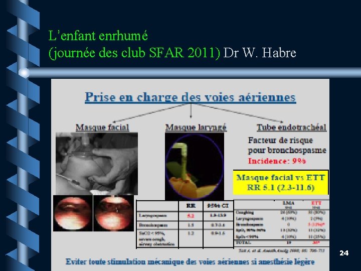 L’enfant enrhumé (journée des club SFAR 2011) Dr W. Habre 24 