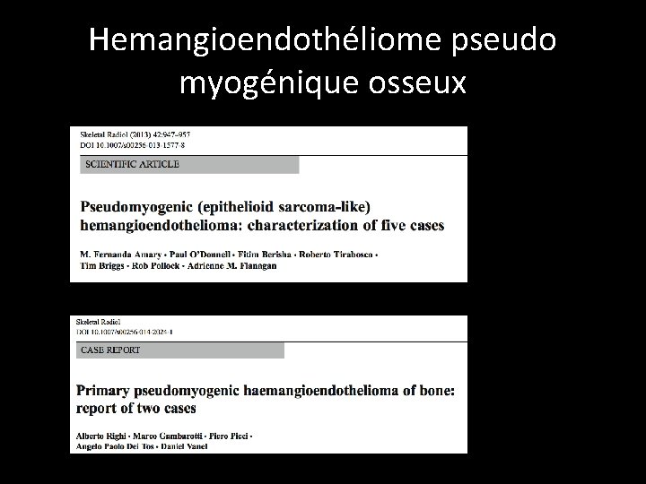 Hemangioendothéliome pseudo myogénique osseux 