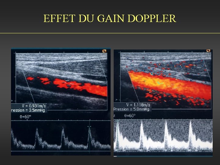 EFFET DU GAIN DOPPLER 