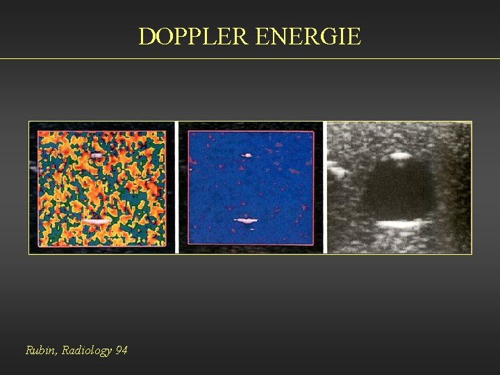 DOPPLER ENERGIE Rubin, Radiology 94 