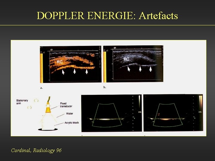 DOPPLER ENERGIE: Artefacts Cardinal, Radiology 96 