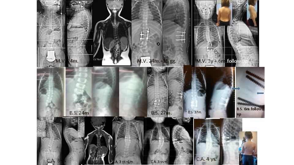 M. V. 24 m. +15 gg. B. S. 24 m C. A. 3 ys